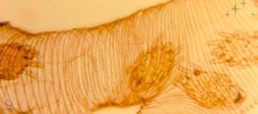 کنه تراشه ای زنبور عسل یا کنه آکاراپیس